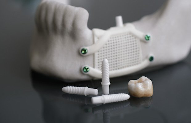陶瓷3D打印是牙科产品迈出的一步