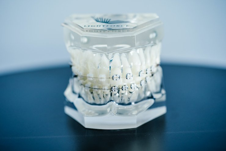 LightForce Orthodontics在最新一轮融资，推动牙齿矫正数字化浪潮