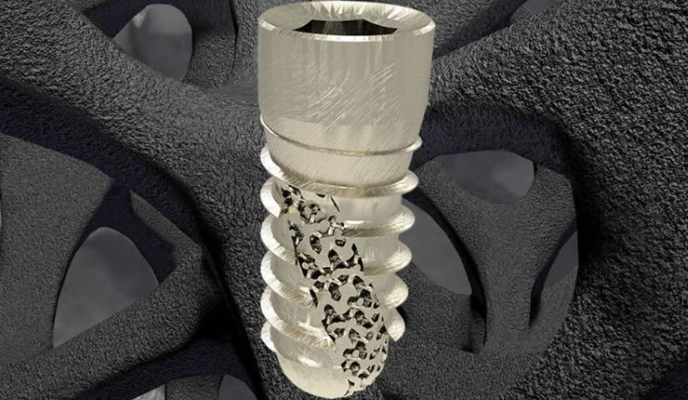 6K Additive与Z3DLab合作为实现3D打印技术应用的高性能钛粉