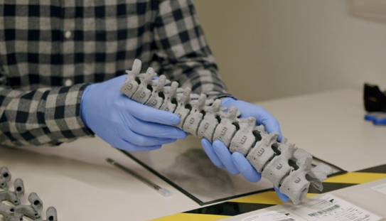 Mighty Oak Medical与惠普合作，利用3D打印技术改进脊椎手术