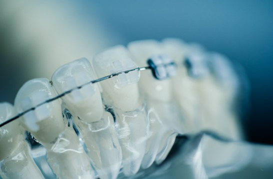 Lightforce Orthodontics获得8000万美元融资，将推进3D打印牙科定制化生产发展