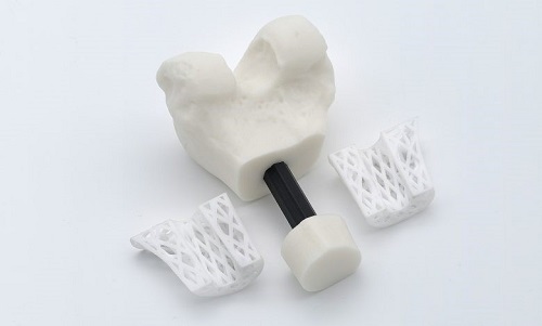 BellaSeno 为汉诺威医学院 3D 打印可吸收骨支架